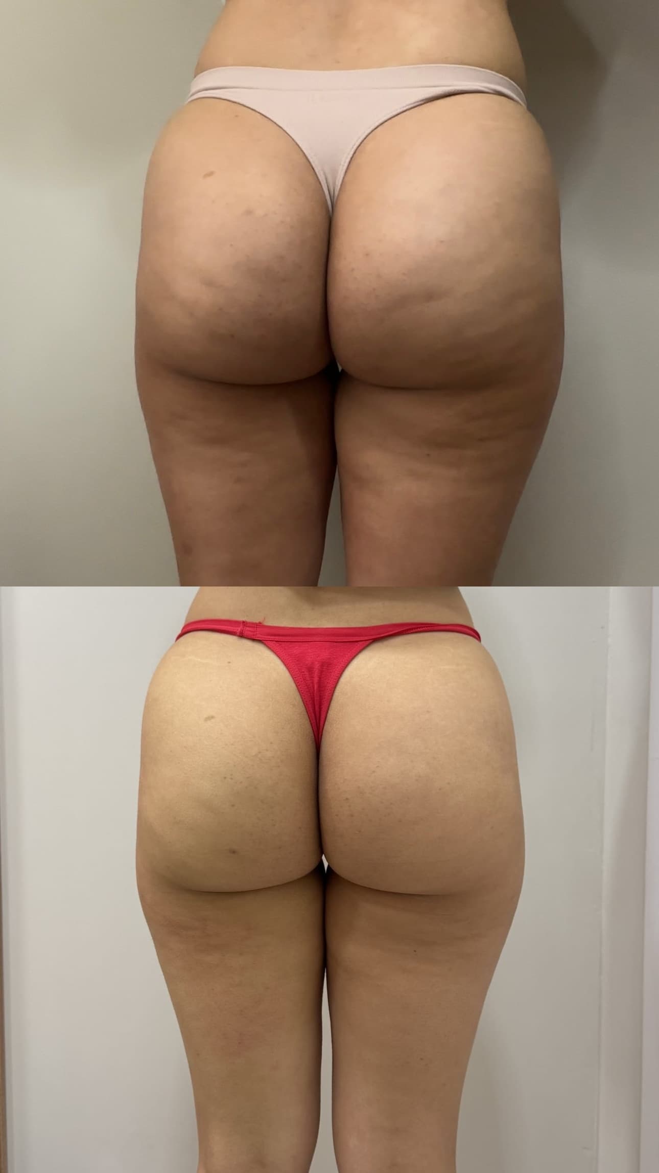 Comparação posterior de antes e depois de cuidado corporal